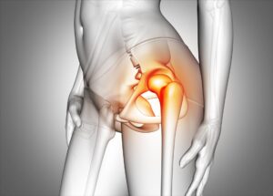 Czy ból biodra może być od kręgosłupa